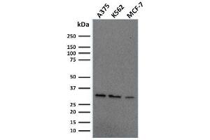 Western Blot Analysis of Human A375, K562, MCF-7 cell lysate using Replication Protein A2 Mouse Monoclonal Antibody (RPA2/2106). (RPA2 antibody)