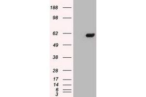 Image no. 4 for anti-Checkpoint Kinase 2 (CHEK2) antibody (ABIN1497499) (CHEK2 antibody)