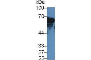 Detection of AMY2A in Rat Serum using Polyclonal Antibody to Amylase, Alpha 2A (AMY2A) (AMY2A antibody  (AA 201-473))