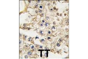 Formalin-fixed and paraffin-embedded human testis tissue reacted with EPHA10 antibody (N-term), which was peroxidase-conjugated to the secondary antibody, followed by DAB staining. (EPH Receptor A10 antibody  (N-Term))