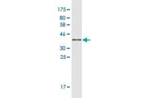 Western Blot detection against Immunogen (36. (TNFAIP2 antibody  (AA 552-650))