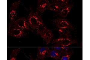 Confocal immunofluorescence analysis of Hela cells using GM130 Polyclonal Antibody at dilution of 1:400. (Golgin A2 (GOLGA2) antibody)