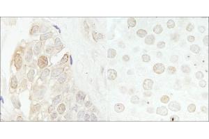 Immunohistochemistry (IHC) image for anti-Cyclin-Dependent Kinase 2 (CDK2) (AA 248-298) antibody (ABIN7454787)