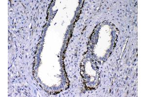 IHC analysis of NOV/CCN3 using anti-NOV/CCN3 antibody .