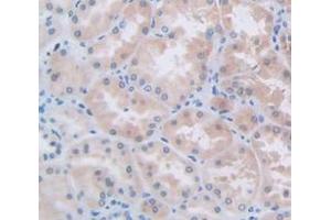 IHC-P analysis of Human Tissue, with DAB staining. (L1CAM antibody  (AA 218-423))