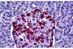 Human Pancreas, Islets of Langerhans: Formalin-Fixed, Paraffin-Embedded (FFPE) (HGS antibody  (AA 451-500))