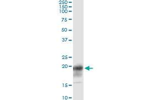 Immunoprecipitation of CD247 transfected lysate using anti-CD247 monoclonal antibody and Protein A Magnetic Bead , and immunoblotted with CD247 MaxPab rabbit polyclonal antibody. (CD247 antibody  (AA 1-164))