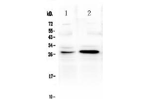 Western blot analysis of TNFRSF18 using anti-TNFRSF18 antibody . (TNFRSF18 antibody  (AA 178-241))