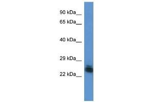 Western Blot showing FYTTD1 antibody used at a concentration of 1. (FYTTD1 antibody  (Middle Region))