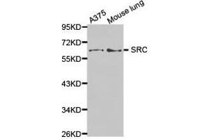 Western Blotting (WB) image for anti-Proto-oncogene tyrosine-protein kinase Src (Src) antibody (ABIN1874936) (Src antibody)