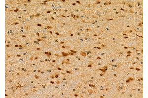 ABIN6266199 and ABIN6277358 at 1/100 staining Rat brain tissue by IHC-P.