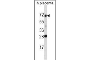 Western blot analysis in human placenta tissue lysates (35ug/lane). (SPINT1 antibody  (AA 178-207))