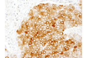 Immunohistochemistry (IHC) image for anti-Host Cell Factor C1 Regulator 1 (XPO1 Dependent) (HCFC1R1) (AA 1-50) antibody (ABIN7454766)