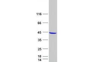 Validation with Western Blot (GALM Protein (Myc-DYKDDDDK Tag))