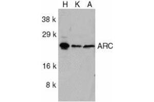 Western blot analysis of ARC in HeLa (H), KB (K), and A549 (A) whole cell lysates with AP30076PU-N ARC antibody at 1/1000 dilution.