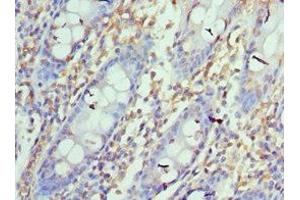 Immunohistochemistry of paraffin-embedded human colon tissue using ABIN7164673at dilution of 1:100 (PD-L1 antibody  (AA 19-238))