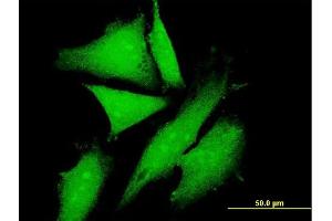 Immunofluorescence of purified MaxPab antibody to KLC2 on HeLa cell. (KLC2 antibody  (AA 1-622))