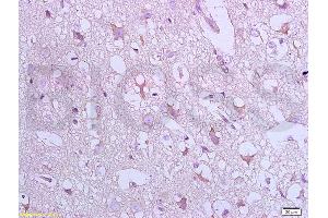 Formalin-fixed and paraffin embedded: rat brain tissue labeled with Anti-Bax Polyclonal Antibody, Unconjugated (ABIN725390) at 1:800 followed by conjugation to the secondary antibody and DAB staining (BAX antibody  (AA 84-175))