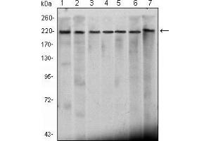 Western blot analysis using CHD3 mouse mAb against Hela (1), K562 (2), Jurkat (3), NTERA-2 (4), HEK293 (5), Raji (6) cell lysate and mouse brain (7) tissue lysate. (CHD3 antibody)