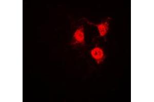 Immunofluorescent analysis of CDK2 staining in Jurkat cells.