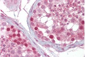 Immunohistochemistry with Testis tissue at an antibody concentration of 5µg/ml using anti-IFT88 antibody (ARP53658_P050) (IFT88 antibody  (Middle Region))