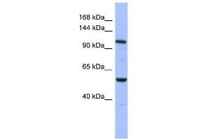 WB Suggested Anti-ZFPM1 Antibody Titration:  0. (ZFPM1 antibody  (Middle Region))