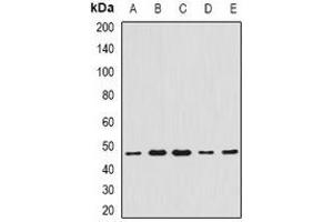 Western blot analysis of CCBL1 expression in Hela (A), A549 (B), mouse liver (C), mouse heart (D), rat kidney (E) whole cell lysates. (CCBL1 antibody)