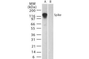 Image no. 1 for anti-SARS-Coronavirus Spike Protein (SARS-CoV S) (AA 19-35) antibody (ABIN199988) (SARS-CoV Spike antibody  (AA 19-35))