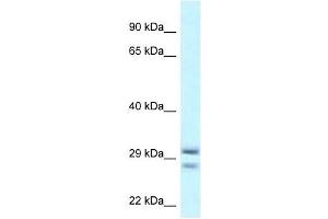 Western Blot showing RIT1 antibody used at a concentration of 1 ug/ml against THP-1 Cell Lysate (RIT1 antibody  (Middle Region))