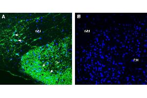 Expression of L1CAM in rat spinal cord.
