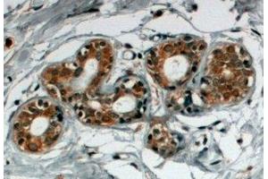 ABIN2560056 (4µg/ml) staining of paraffin embedded Human Breast. (SNX5 antibody  (C-Term))