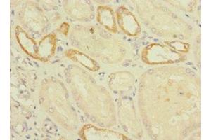 Immunohistochemistry of paraffin-embedded human kidney tissue using ABIN7175037 at dilution of 1:100 (C2ORF76 antibody  (AA 1-126))