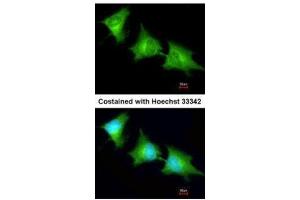 ICC/IF Image Immunofluorescence analysis of methanol-fixed HeLa, using SPR, antibody at 1:200 dilution.