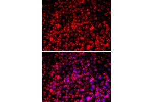 Immunofluorescence analysis of A549 cells using TOMM20 antibody. (TOMM20 antibody  (AA 20-145))