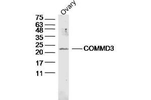 Mouse ovary lysates probed with COMMD3 Polyclonal Antibody, unconjugated  at 1:300 overnight at 4°C followed by a conjugated secondary antibody at 1:10000 for 90 minutes at 37°C. (COMMD3 antibody  (AA 101-195))