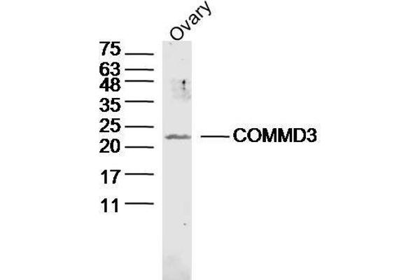 COMMD3 anticorps  (AA 101-195)