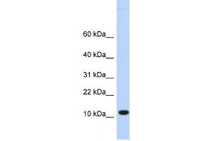 WB Suggested Anti-C10orf57 Antibody Titration:  0. (CJ057 antibody  (Middle Region))