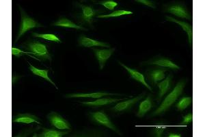 Immunofluorescence of monoclonal antibody to ALOX15B on HeLa cell. (ALOX15B antibody  (AA 181-280))