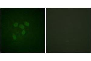 Immunofluorescence analysis of HeLa cells, using p53 (Acetyl-Lys317) Antibody.