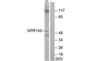 Western blot analysis of extracts from Jurkat cells, using GPR142 Antibody. (GPR142 antibody  (AA 1-50))