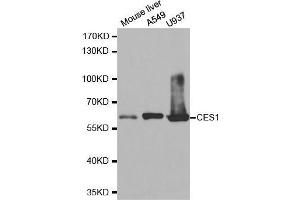 Western blot analysis of extracts of various cell lines, using CES1 antibody. (CES1 antibody  (AA 287-566))