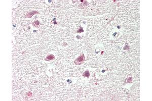 Human Brain, Cortex: Formalin-Fixed, Paraffin-Embedded (FFPE). (CBX4 antibody  (AA 53-102))