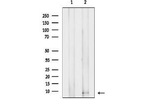 anti-FAT Tumor Suppressor Homolog 1 (FAT1) antibody