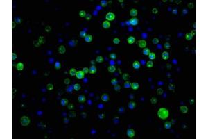 Immunofluorescence staining of Raji cells with ABIN7127277 at 1:34,counter-stained with DAPI. (Recombinant CD21 antibody)
