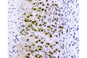 IHC analysis of GOLPH3 using anti-GOLPH3 antibody (ABIN6719570). (GOLPH3 antibody  (AA 56-298))