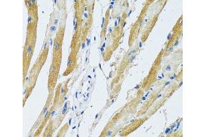 Immunohistochemistry of paraffin-embedded Rat heart using GDAP1 Polyclonal Antibody at dilution of 1:100 (40x lens). (GDAP1 antibody)