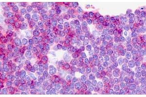 Human Thymus: Formalin-Fixed, Paraffin-Embedded (FFPE) (CD3 antibody)