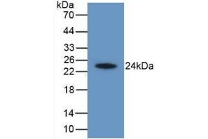 Detection of Recombinant HAVCR2, Human using Monoclonal Antibody to Hepatitis A Virus Cellular Receptor 2 (HAVCR2) (TIM3 antibody  (AA 22-202))