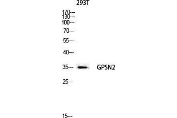 TECR antibody  (C-Term)