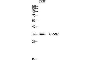 Western Blot (WB) analysis of 293T lysis using GPSN2 antibody. (TECR antibody  (C-Term))